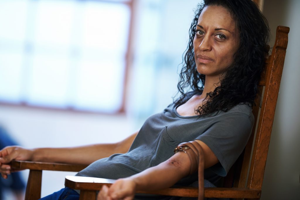 Drug addict sitting in a chair with a belt around her arm.